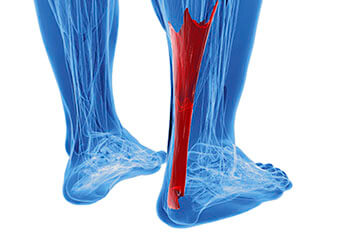 Achilles tendonitis treatment in the Cook County, IL: Northwest Chicago (Maywood, Elmhurst, Cicero, Oak Park, Rosemont, Evanston, Des Plaines, Glenview, Elk Grove Village, Lombard), Ukrainian Village / Wicker Park (Norridge, Maywood, Melrose Park, Berwyn, Westchester, Lincolnwood, Niles) and Southwest Chicago (Bridgeview, Burbank, Alsip, Orland Park, Lemont, Tinley Park) areas