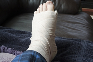 How to Manage a Broken Foot
