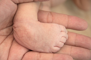 Understanding Clubfoot